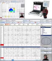 Máy điện não NEUROWERK EEG 23