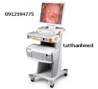 Máy soi cổ tử cung kỹ thuật số WS-2000 Goldway